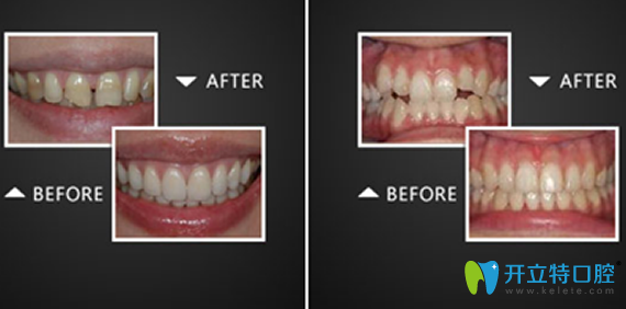 淮安口腔哪家好？看完牙知道口腔牙齒美容案例就知道