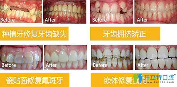北京拜博口腔看牙效果好不好