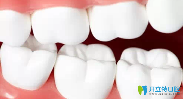 牙齒咬合力過大也容易引起牙齒松動(dòng)