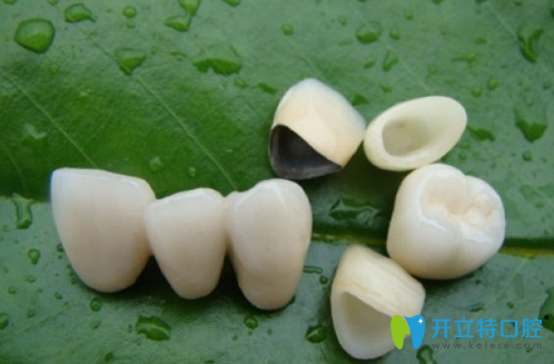 鈷鉻烤瓷牙的價(jià)格，壽命及優(yōu)缺點(diǎn)大揭秘