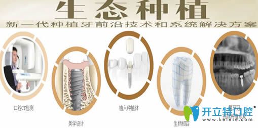 成都唐牙科生態(tài)種植牙分解圖