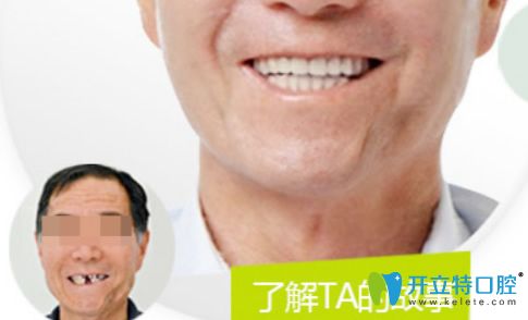 北極星口腔單顆牙缺失種植案例