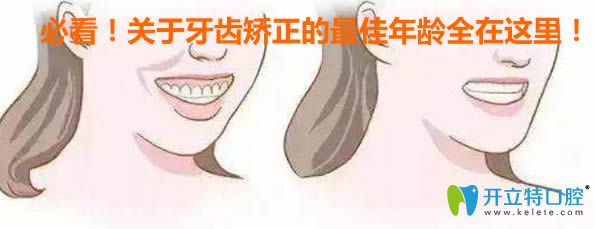 內(nèi)幕！如果錯過了牙齒矯正的較佳年齡，會讓你后悔一輩子