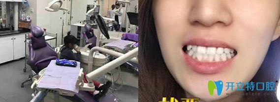 潔牙后顧客評(píng)價(jià)北京今生口腔