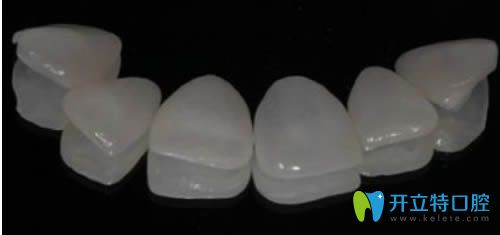 合肥壹加壹程紅梅解說(shuō)牙齒貼面能維持多久