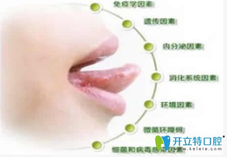 經(jīng)常口腔潰瘍是什么原因及治療方法大全