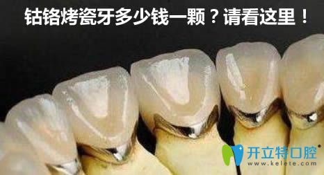 鈷鉻合金烤瓷牙多少錢一顆?看了價(jià)格表就知道500元貴不貴了