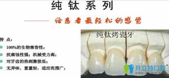 m.gh0097.com純鈦烤瓷牙圖片