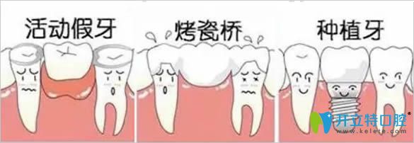 青島天皓口腔門(mén)診牙齒修復(fù)方式圖