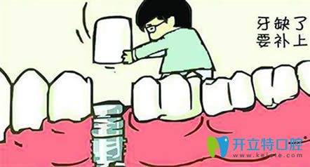 牙齦萎縮還能種植牙嗎?重慶皇仕口腔舒斯特院長(zhǎng)給出詳解