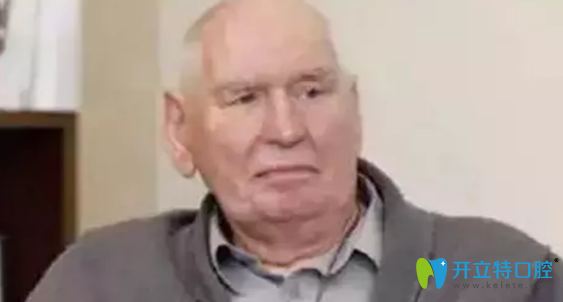 種植牙使用時(shí)間較長(zhǎng)的42歲的瑞典人Sven Johansson