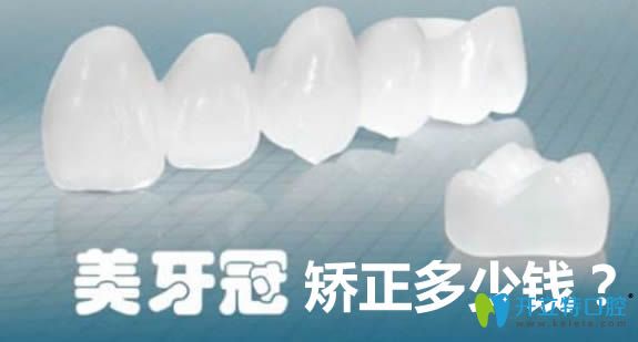 美容冠牙齒矯正大概需要多少錢?請(qǐng)看本文提供的價(jià)格一覽表