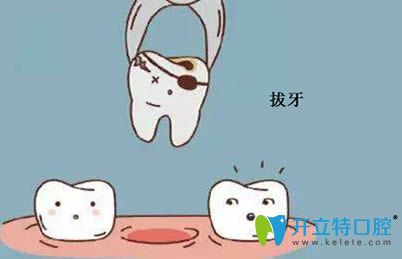 開立特牙齒松動(dòng)怎么治療之拔牙