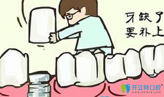 拔牙后多久可以鑲牙？拔牙后鑲牙有沒有時(shí)間？