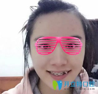 <!--<i data=20240703-sp></i>-->華爾康口腔矯正虎牙前