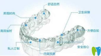 隱適美隱形矯正器