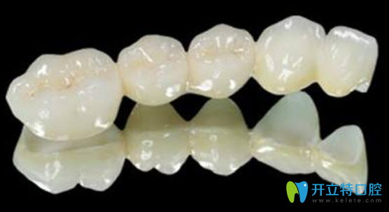 補(bǔ)一顆烤瓷牙多少錢？鑲的烤瓷使用10年正常嗎？