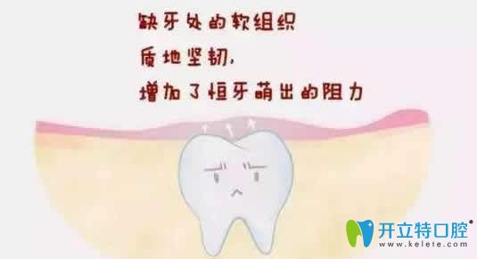 請問大家埋伏牙一定要拔嗎不拔有什么危害