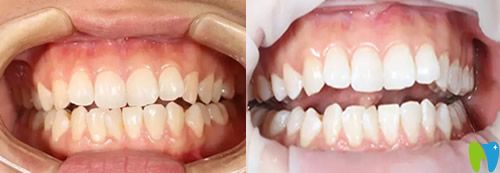 重慶牙科哪里好？看完美維口腔真人案例+價(jià)格表你還不心動(dòng)