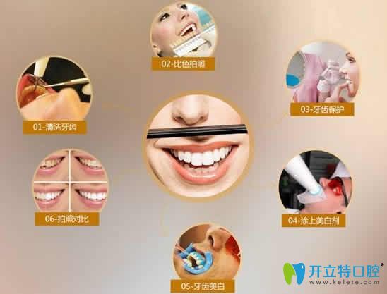  牙黑牙黃做牙齒冷光美白多少錢(qián)?國(guó)內(nèi)全新價(jià)格及注意事項(xiàng)