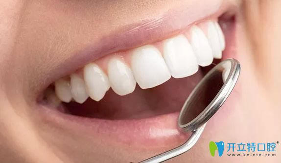 冷光美白牙齒多少錢一次