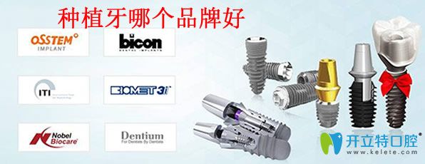 牙齒種植五大品牌新鮮出爐另附韓國(guó)種植牙價(jià)格多少錢一顆