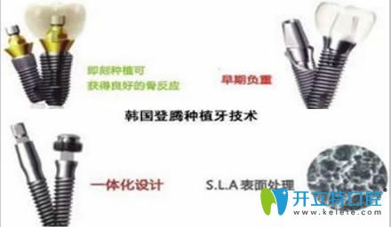 登騰種植牙為什么便宜?解析韓國(guó)登騰種植體的價(jià)格和壽命