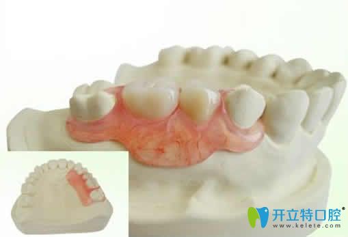 求問隱形義齒對鄰牙有危害嗎？揭秘隱形義齒的優(yōu)缺點