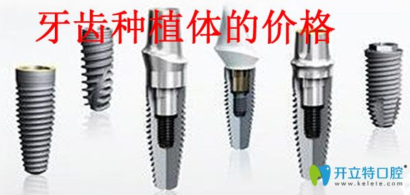 牙齒種植體的價(jià)格