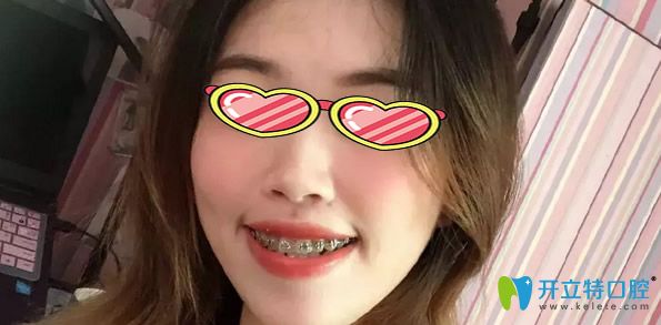 東南口腔正畸效果好不好
