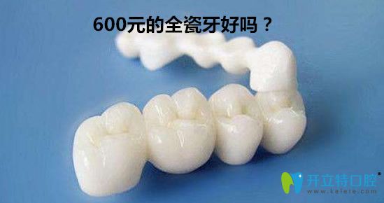 600元的全瓷牙好嗎？全瓷牙套1000一顆貴嗎