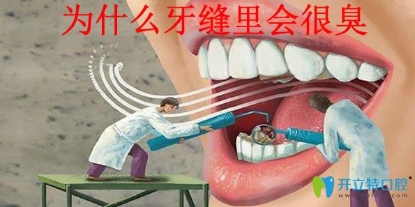 快來(lái)圍觀牙縫臭怎么辦 為你揭曉牙縫臭的原因和解決方法