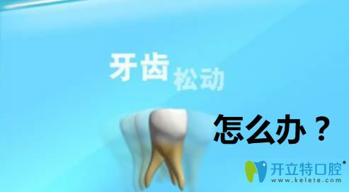 牙齒松動(dòng)怎么治療？做修復(fù)的話價(jià)格大概需要多少錢？