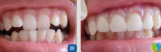 天津美萊口腔高志永怎么樣？真人案例及反饋來(lái)嘍