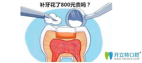 杭州口腔醫(yī)院補(bǔ)牙800元貴不貴?求2024杭州口腔醫(yī)院補(bǔ)牙價(jià)格表