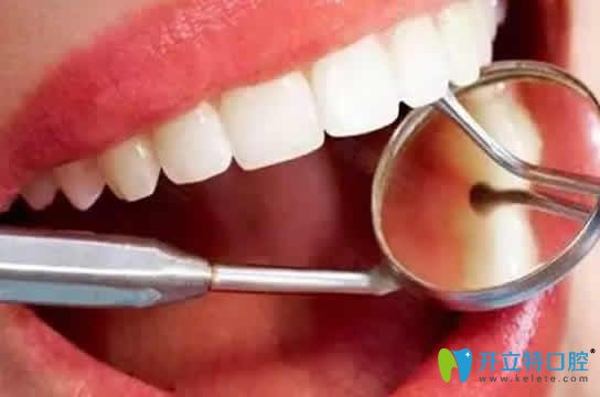 洗牙對(duì)牙齒好嗎？這里告訴你洗牙對(duì)牙齒有沒有傷害