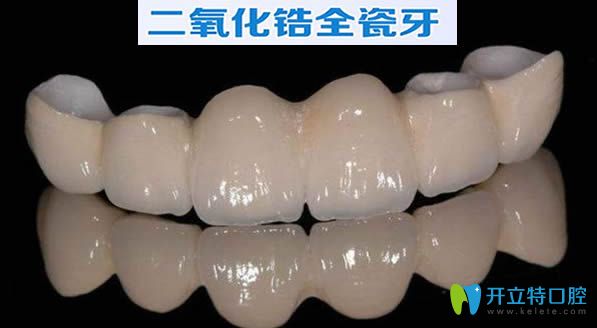 公布二氧化鋯全瓷牙價格表 看完就知道全瓷牙套多少錢一顆