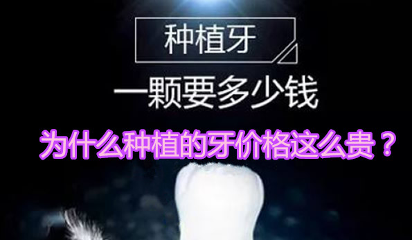 為什么種植的牙價(jià)格這么貴 種植體品牌和牙冠種類(lèi)占大部分