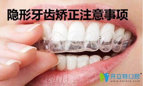 武漢壹加壹口腔周寧科普隱形牙齒矯正注意事項(xiàng)