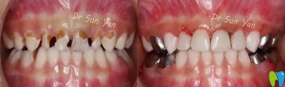 武漢第 一口腔舒適化<span style=