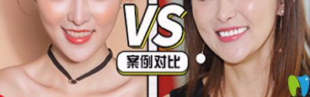 牙博士口腔泉州補(bǔ)牙哪家好？來看牙博士口腔補(bǔ)牙治療前后對(duì)比案例