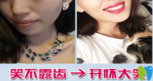 深圳麥芽口腔矯正牙齒對比圖