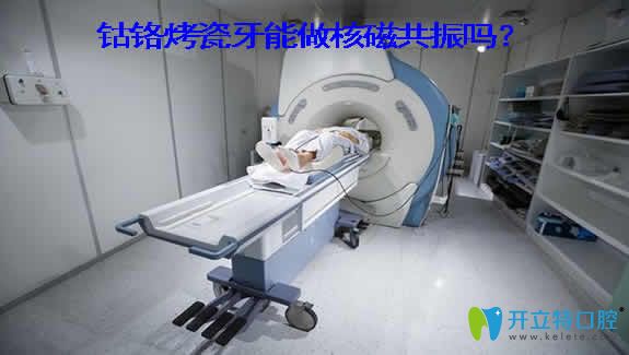 良心牙醫(yī)解析：鈷鉻烤瓷牙能做核磁共振嗎？