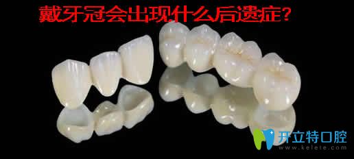 戴牙冠會(huì)出現(xiàn)什么后遺癥？介紹牙冠的種類及價(jià)格
