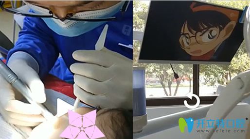 去昆明瑾帆口腔給孩子補牙