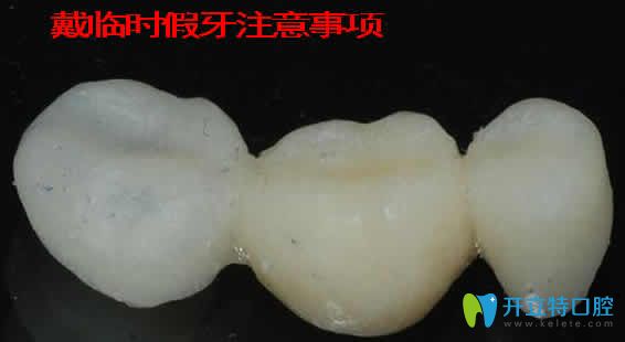 戴臨時假牙注意事項