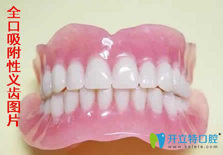 揭秘：什么是全口吸附性義齒及吸附性義齒的優(yōu)缺點
