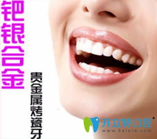 鈀銀烤瓷牙好不好?銀鈀合金烤瓷牙優(yōu)缺點(diǎn)及價(jià)格和圖片介紹
