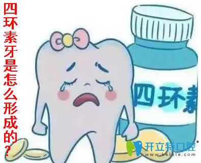 四環(huán)素牙是怎么形成的