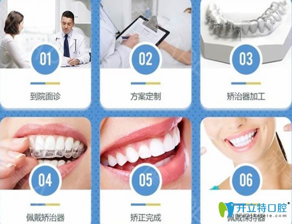 <!--<i data=20240703-sp></i>-->牙齒矯正流程
